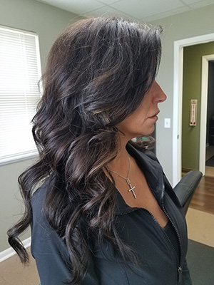 Hair Loss Replacement